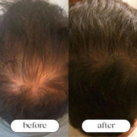 RedFuzion™ Hair Boost Vitality Hat view 3